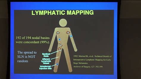Sentinel Lymph Node Biopsy In The Surgical Management Of Melanoma Youtube