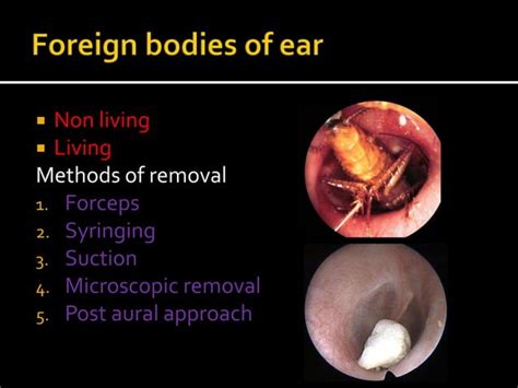 Diseases Of The External Ear Ppt