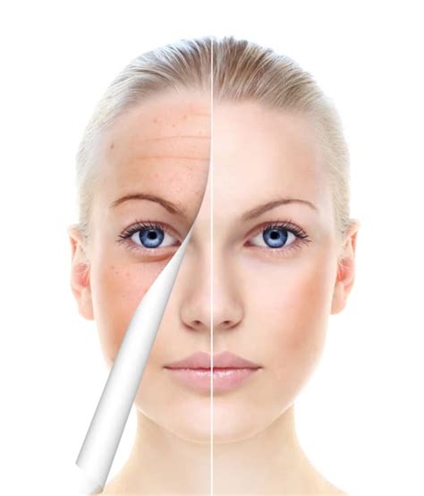 Ageing Face Solihull Medical Cosmetic Clinic