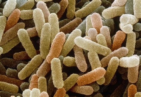 Coloured Sem Of Bacillus Sp Bacteria Stock Image B2201034