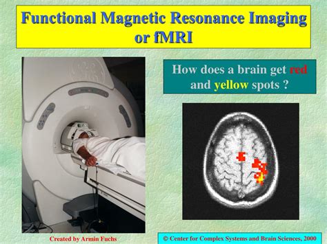 セール最安価格 Functional Magnetic Resonance Image For Jp