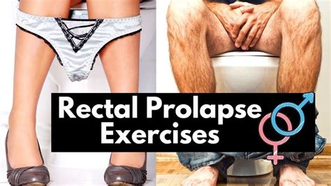 rectal prolapse exercises and bowel emptying technique physio to avoid prolapse worsening