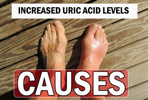 What Causes Increased Level Of Uric Acid In The Body