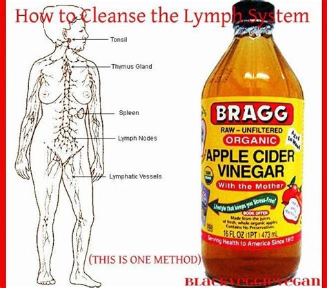 Related Image Apple Cider Vinegar Remedies Organic Apple Cider