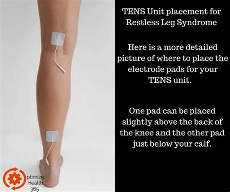 Ideal Tens Unit Placement For Restless Leg Syndrome Optimize Health 365