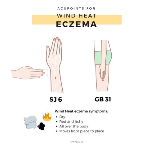 How Does Chinese Medicine View Eczema In 2020 Chinese Medicine Tcm