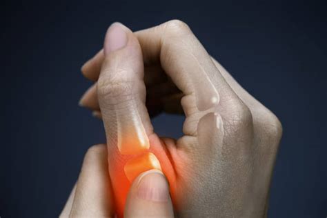 Broken Thumb Symptoms Treatment And Recovery