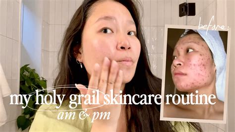 My Holy Grail Skincare Routine Healing Severe Acne Scarring Texture