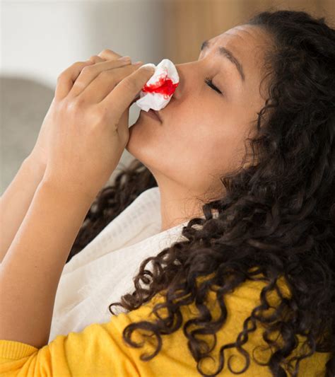 Nosebleeds In Teenagers Causes Treatment And Prevention Momjunction