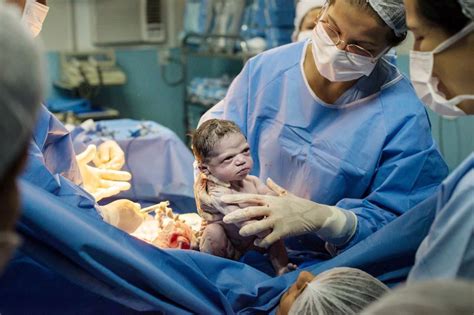 Newborn Brazilian Baby Frowns At Doctor Seconds After Delivery Turns