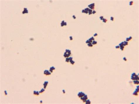 Gram Positive Cocci In Clusters