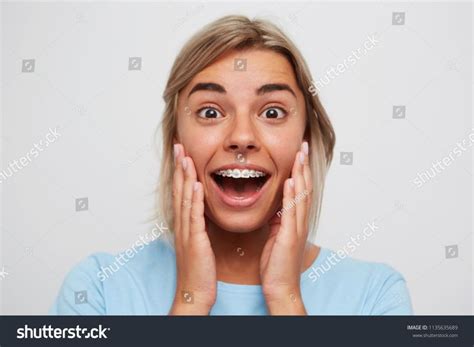 Closeup Of Cheerful Excited Young Woman With Blonde Hair And Braces On