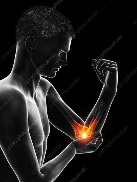 Man With Painful Elbow Illustration Stock Image F0295381
