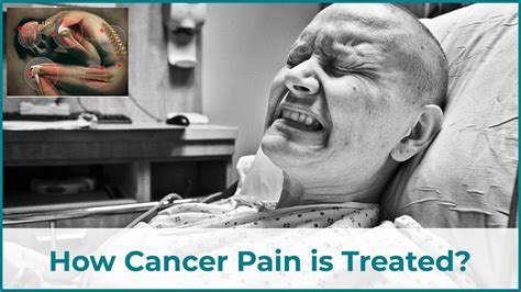 Cancer Pain Treatment How Cancer Pain Is Treated Dr Anil Kamath