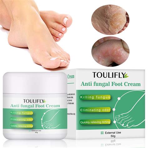 Toulifly Antifungal Cream Foot Fungus Cream Antifungal Treatment Cream