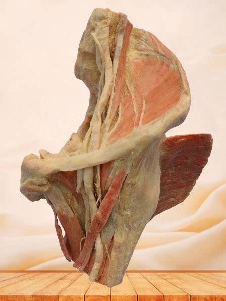 Sagittal Section Of Female Pelvis Plastination