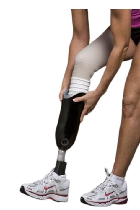 Artificial Carbon Fiber Prosthetic Leg Below The Knee Rs 100000 Id