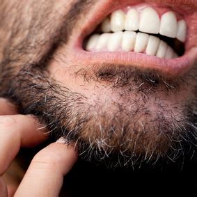 An itchy beard is a common complaint, but what makes it itch? Battling The Itchy Beard Stage - Beard Trimmer Reviews