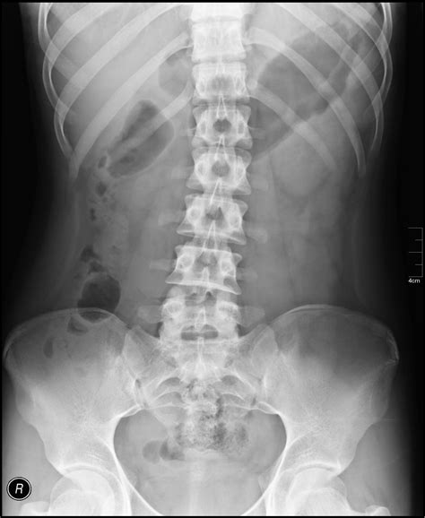 X ray by chris pearce advanced photoshop. X-ray. Causes, symptoms, treatment X-ray