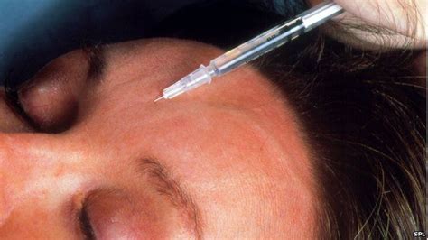 Botox May Stunt Emotional Growth In Young People Bbc News