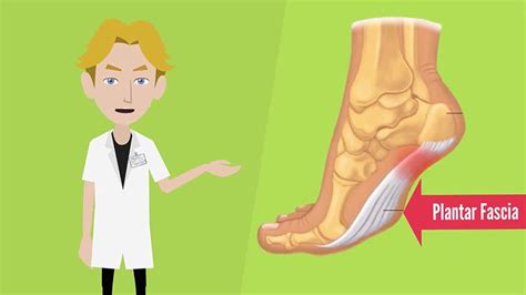 Understanding Heel Spur Treatment Flagstaff Foot Doctors