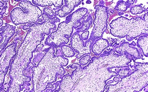 Placental Villi Light Micrograph Stock Image C0571424 Science