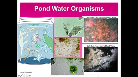 Pond Water Organisms Lab Youtube