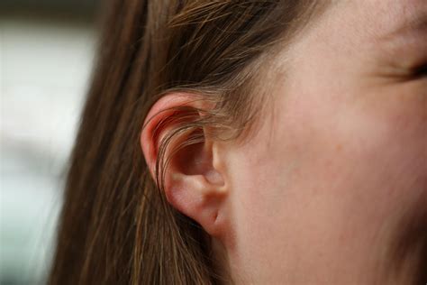 Your Ear Lobe Shape Could Offer Insight Into Genetic Conditions New