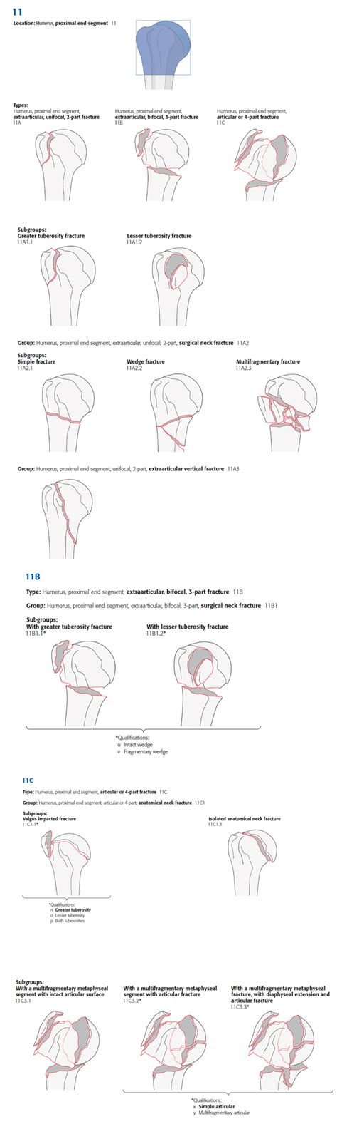 AO OTA Classification For Fractures Of The Proximal Humerus Obtained Download Scientific
