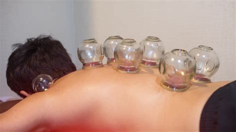What Cupping Really Does To Your Body