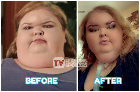 1000 Lb Sisters Tammy Shocks Fans With Huge Weight Loss Pictures 115 Lb Lost Already