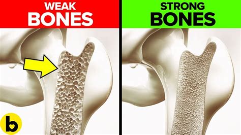 Top 2 Story Of Stronger Bones The Key To A Healthy