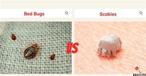 Bed Bugs Vs Scabies Key Differences And Similarities With Easy