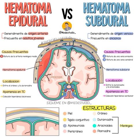 Hematoma Epidural Vs Subdural Anatomia Y Fisiologia Humana Cosas De Enfermeria Anatomia Y