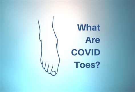 Covid Toes What Is It And What To Do About It