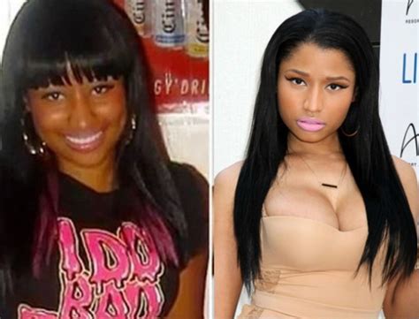 Nicki Minaj Plastic Surgery Explained Celebrity Stats
