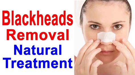 Blackheads Removal Tips Youtube