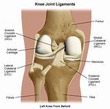 Knee Plica Treatment Images