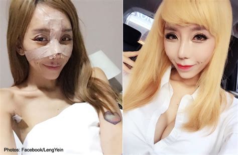 malaysian dj leng yein unveils new look after plastic surgeries in