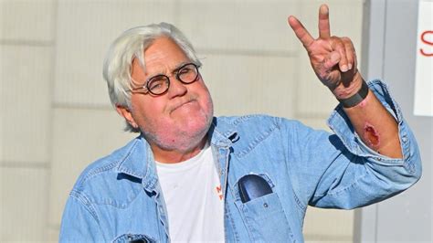 Jay Leno Recalls How Face Caught On Fire In 1st Interview Since