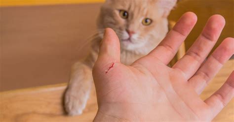 Can Your Cat Make You Sick Cdc Releases Cat Scratch Disease Study