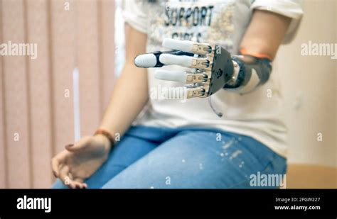 An Amputee Woman Demonstrates Her Bionic Hand 4k Stock Video Footage