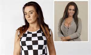Josie Cunningham Model Regrets £5000 Nhs Boob Job And Wants Them