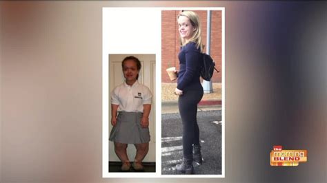 A Life Changing Limb Lengthening Surgery For Women Born With Dwarfism