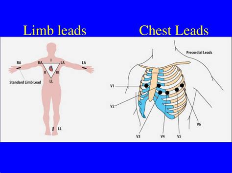 Ppt An Introduction To The 12 Lead Ecg Powerpoint Presentation Free