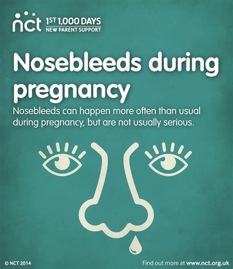 Nose Bleeds In Pregnancy Nose Bleeding During Pregnancy Causes And Remedies Nosebleed In
