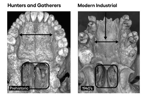 Our Skulls Are Out Evolving Us A Motley Crew Of Scientists Argue That