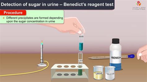 Benedicts Test For Glucose Seliwanoff And Benedicts Test These