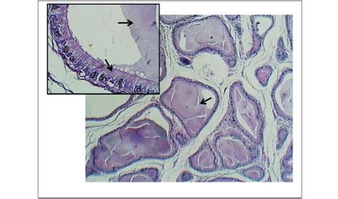 Section Of The Vesicular Gland In Domestic Bull Shows Secretory Unite