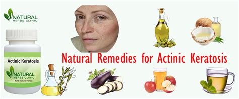Natural Remedies For Actinic Keratosis Treatment Natural Herbs Clinic